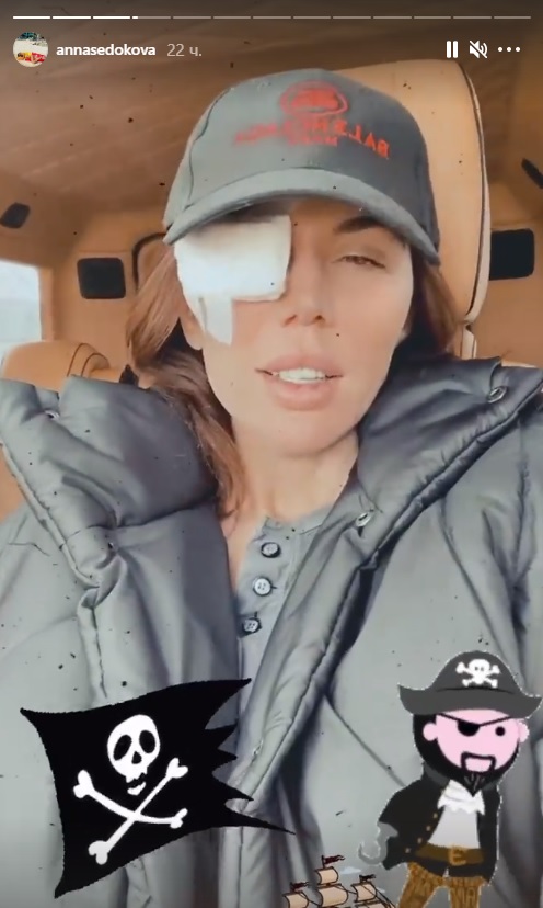 Анне Седоковой сделали операцию: певица показала фото