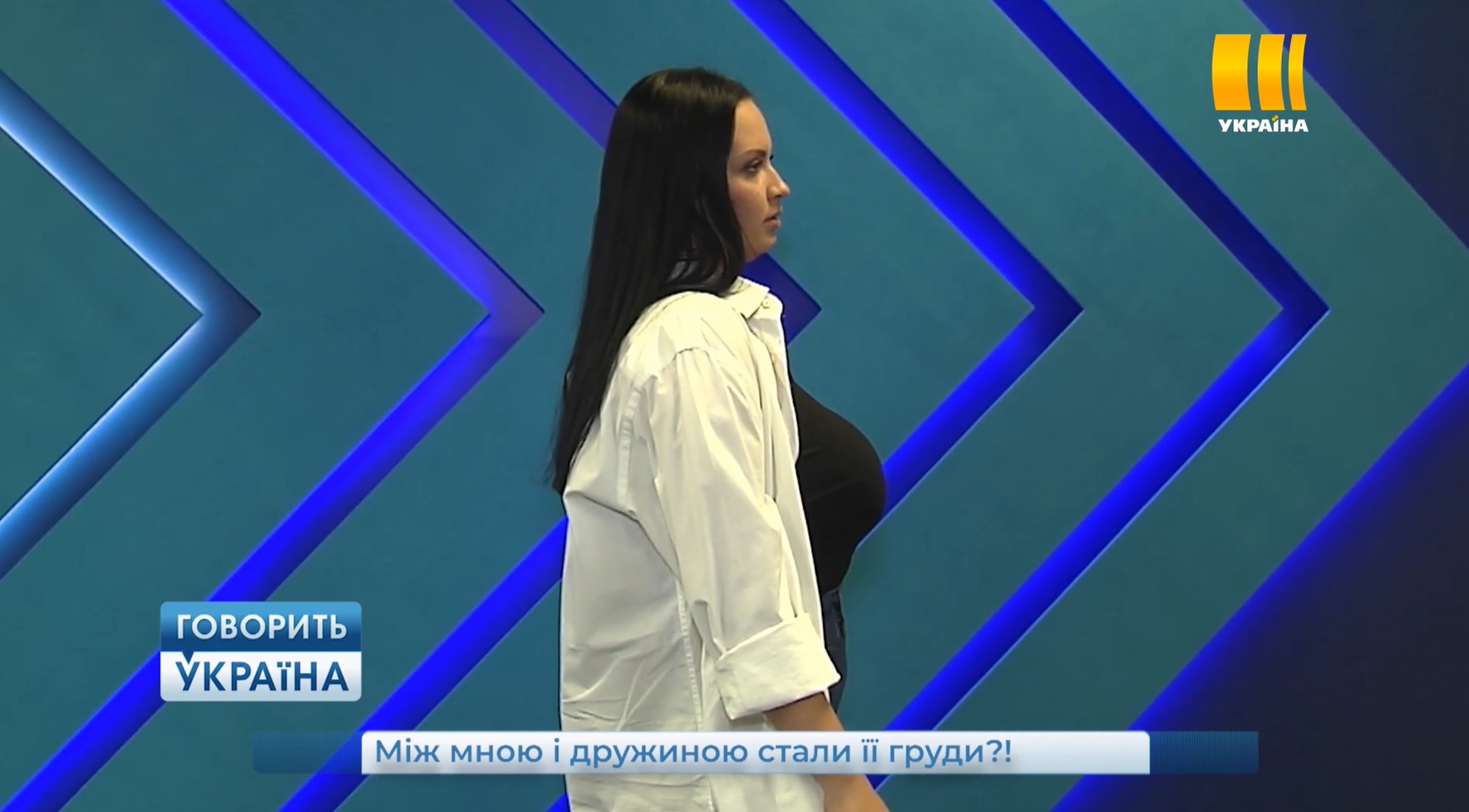 Украинка решила избавиться от своей груди 7 размера: переживаю, чтобы не вырос горб
