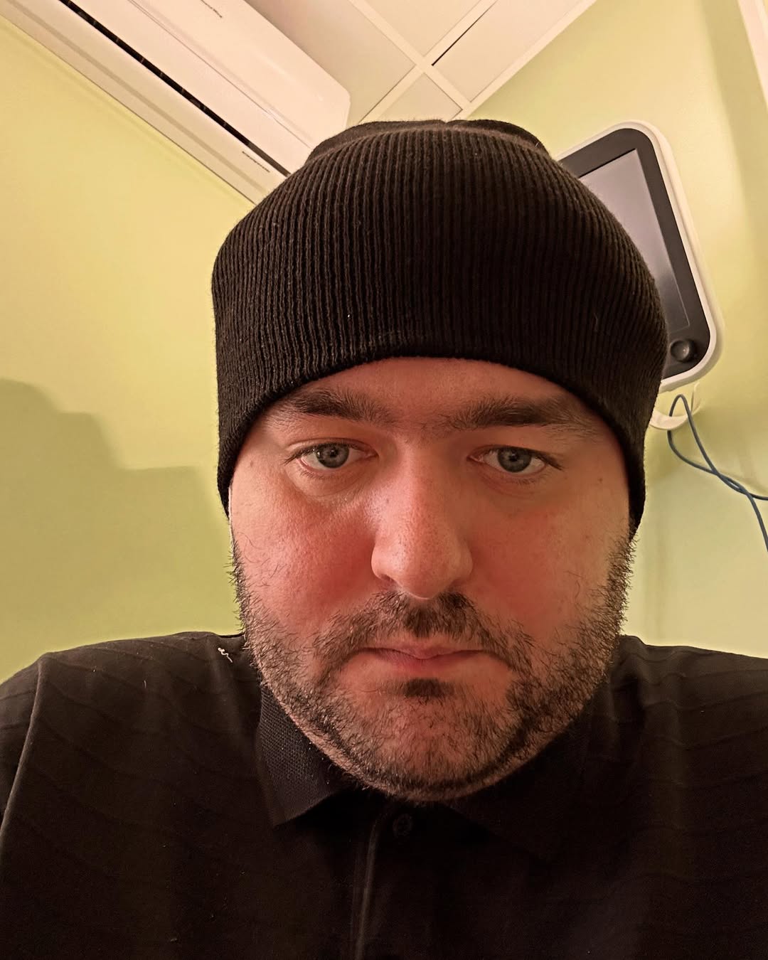 Веня из ВКВ перенес новую операцию: "Теперь 35% моей головы - это сплав титана" (фото)
