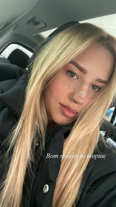 Прокинулася з оновленим носом: Даша Квіткова показала обличчя після пластики