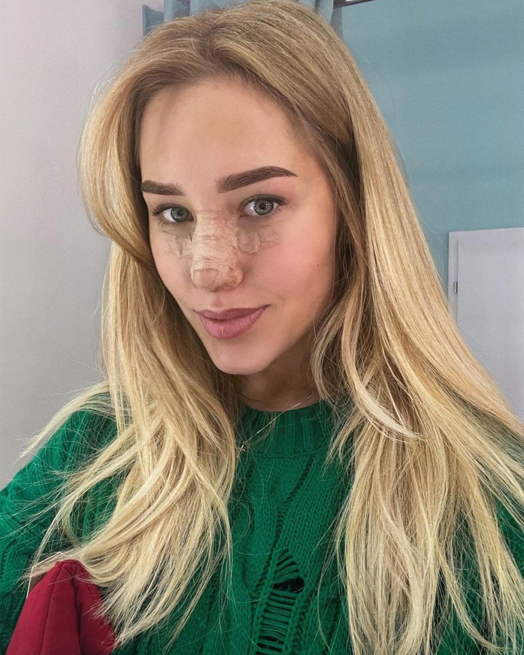 Прокинулася з оновленим носом: Даша Квіткова показала обличчя після пластики