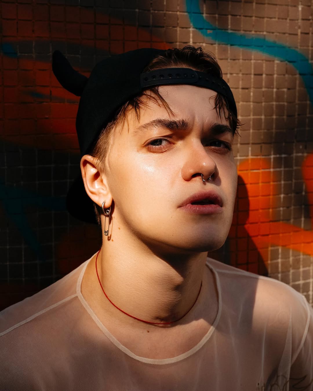 Танцюрист Дорофєєвої вперше про наслідки побиття працівником УДО: &quot;50 шурупів у голові&quot;