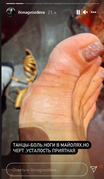 Танцы – боль: Гвоздева прокомментировала совместный номер с MÉLOVIN'ом после скандала на &quot;Танцах со звездами&quot;