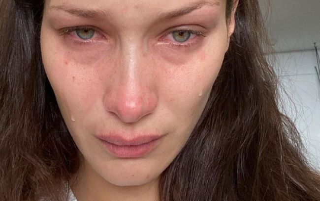 Нужно открыто обсуждать этот ад: Белла Хадид поддержала Украину в войне с Россией