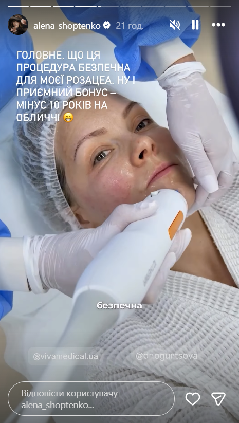 "Решилась": Елена Шоптенко показала результат первой за 38 лет косметологической процедуры