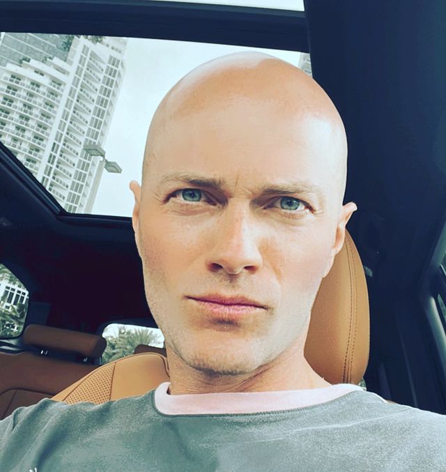 Дружина не впізнає: Влад Яма показав радикальні зміни в зовнішності